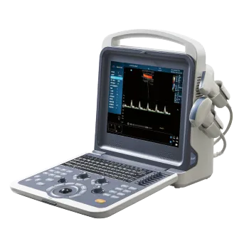 Portable digital ultrasound machine &ultrasound scanner
