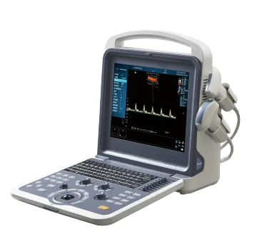 Portable digital ultrasound machine &ultrasound scanner