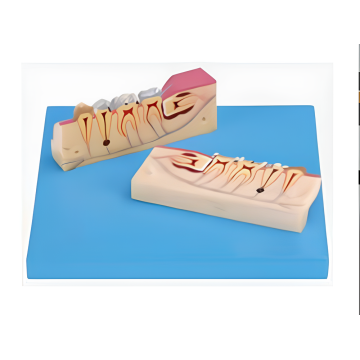 Modèle disséqué de tissu de dents