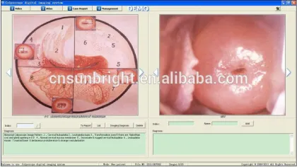 hot colposcopy equipment with trolley on sales promotion