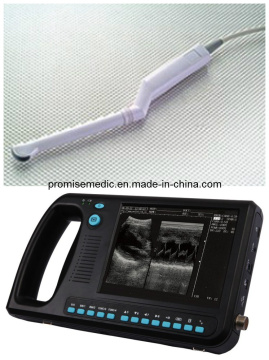 Ultrasound Device (PRO-BCM100) with 6.5MHz Transvaginal Generator
