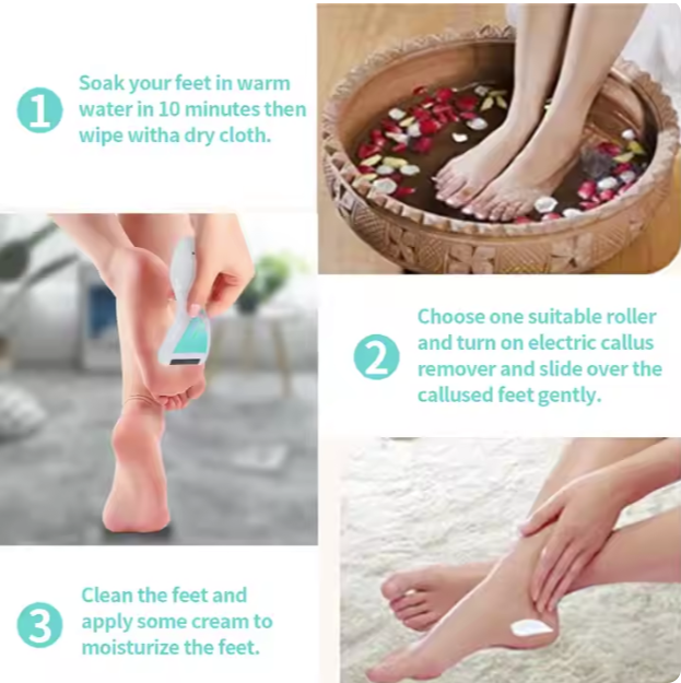 Rechargeable Best Selling Callus Scrubber Electronic Pedicure Foot File Powerful Electric Foot Hard Skin Calluses Remover