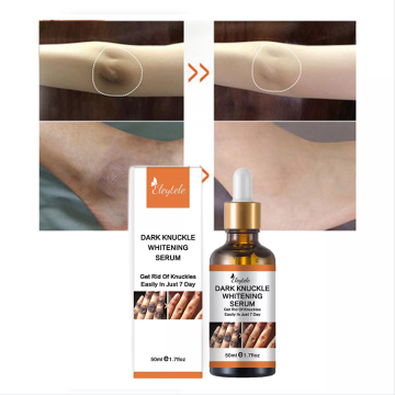 Wholesale Hand and Joint Care Serums for Dark Knuckles and Finger Bleaching