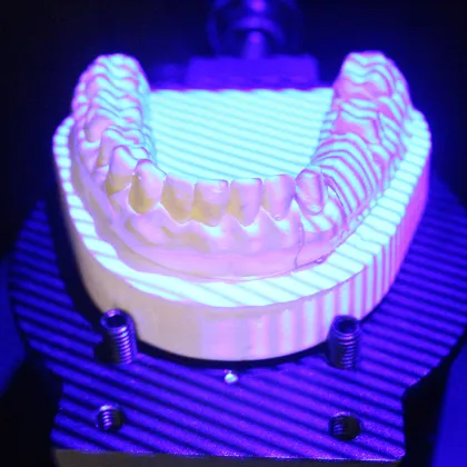 3d dental impression scanner