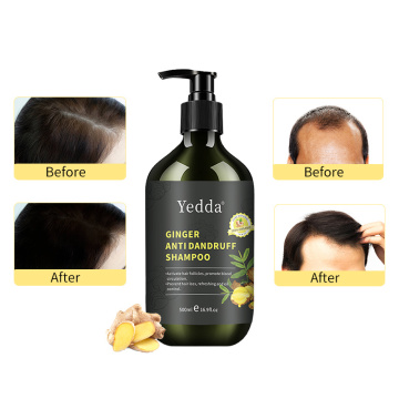 Shampoo per la perdita anti-capelli che rinfrescano allo zenzero biologico per la crescita dei capelli dell'hotel