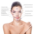 Anti-Aging Facial Fillers Dermal Filler Hyaluronic Acid Breast Buttock Enlargement Manufactory