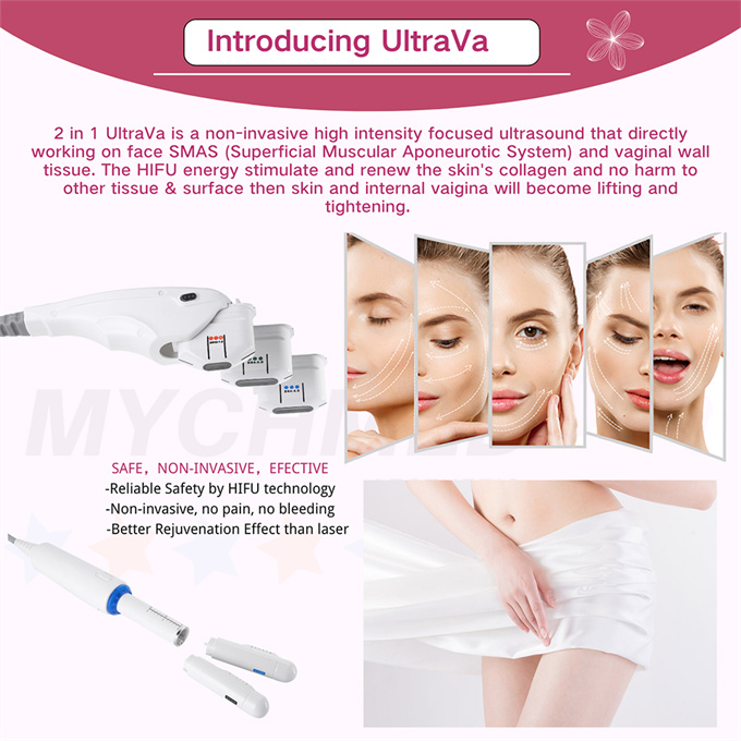 Hifu Vaginal Machine2