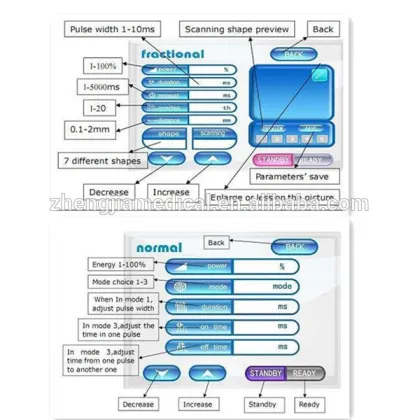 acne scar removal and stretch marks removal co2 laser