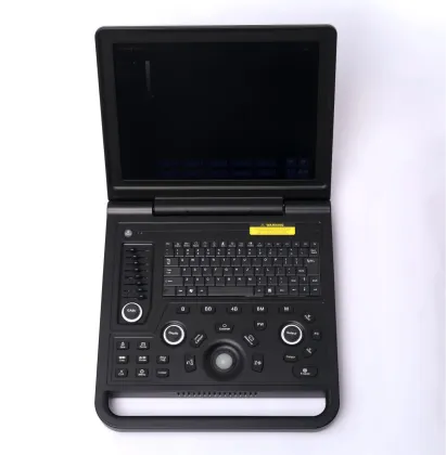 Female liver cyst ultrasound diagnostic instrument