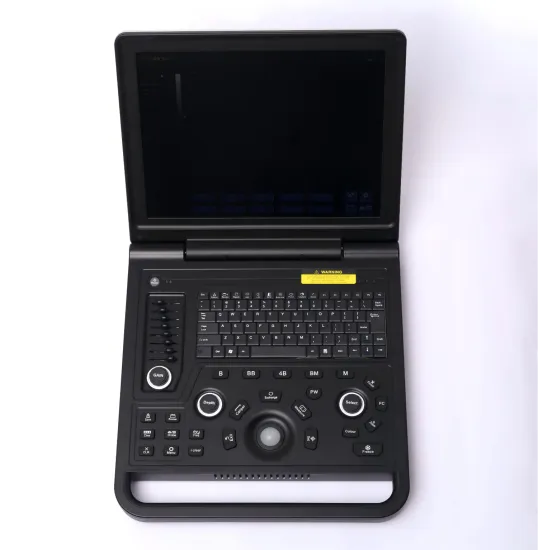 Female liver cyst ultrasound diagnostic instrument