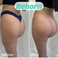 Reborn Polylactide PLLA Filler for Butt Injections