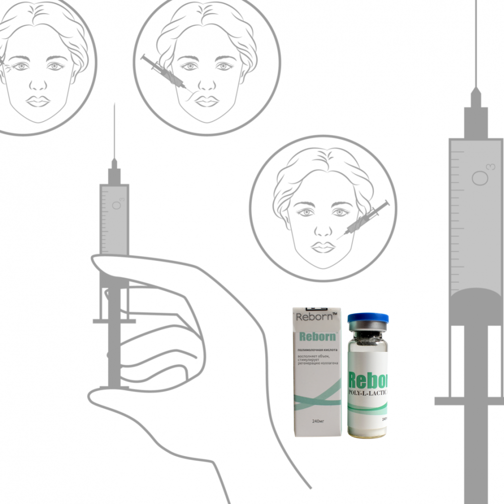 Procedimento de preenchimentos de peito PLLA não cirúrgico