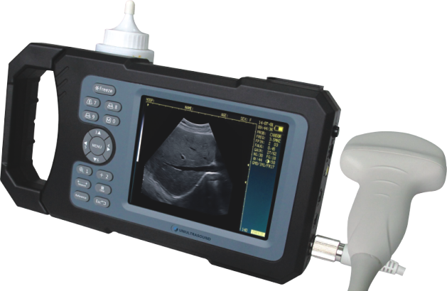 Novo scanner de ultrassom de digitação portátil