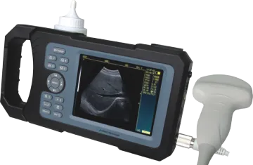 New Handheld Full-digital Ultrasound Scanner