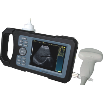 New Handheld Full-digital Ultrasound Scanner