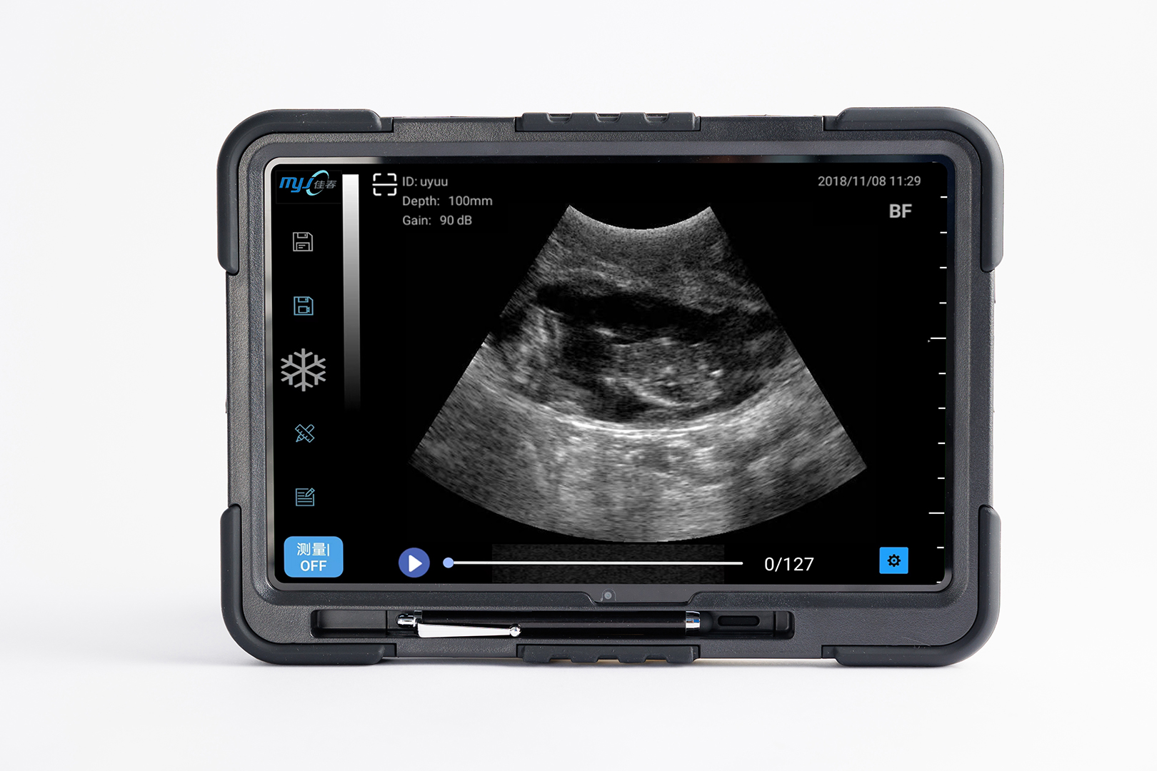 portable ultrasound