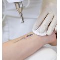 Choicy Academy Tattoo Removal Removal Tender Online