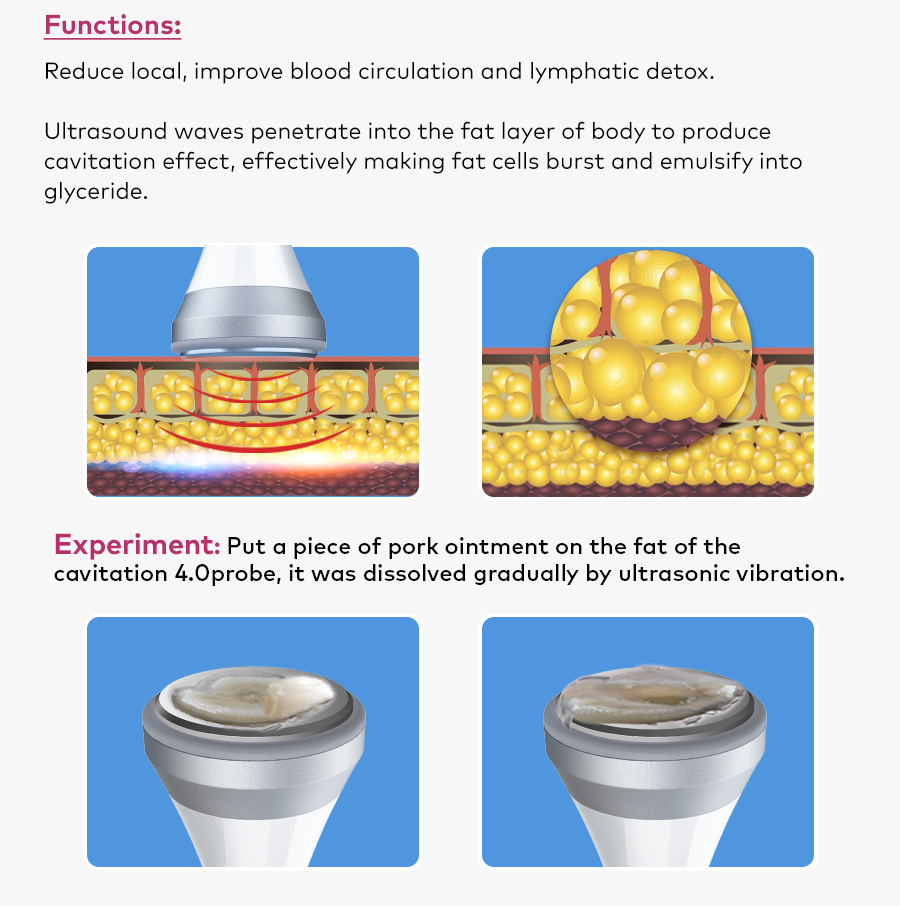 Omeina 80k radiofrequency cavitation machine