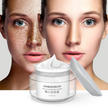 Day Cream for Dry Skin: Anti-Freckle Whitening Moisturizing Facial Cream for Dark Spots
