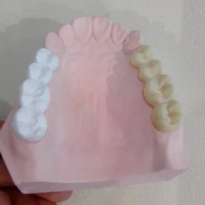 dental crown fabrication machine