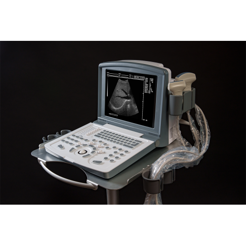 white and black full digital laptop ultrasound scanner