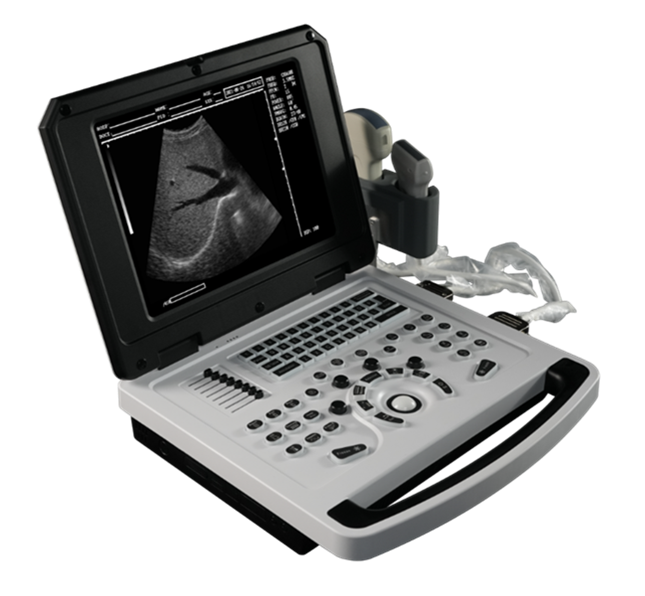 Cheap Notebook Black and White Ultrasound Scanner