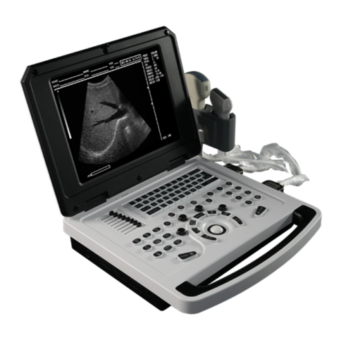 Cheap Notebook Black and White Ultrasound Scanner