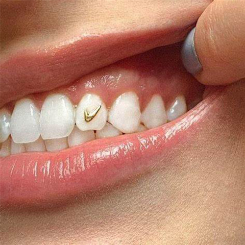 10K 22K Mini Gold Dental Teeth Gems