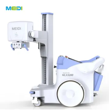 High Frequency Mobile Digital Radiography System