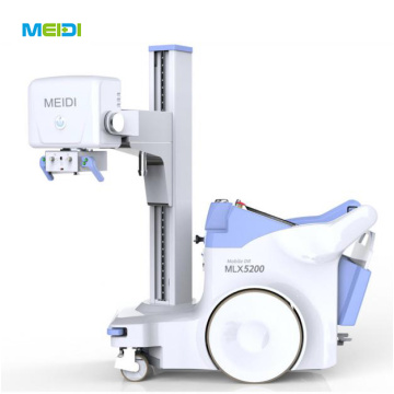High Frequency Mobile Digital Radiography System