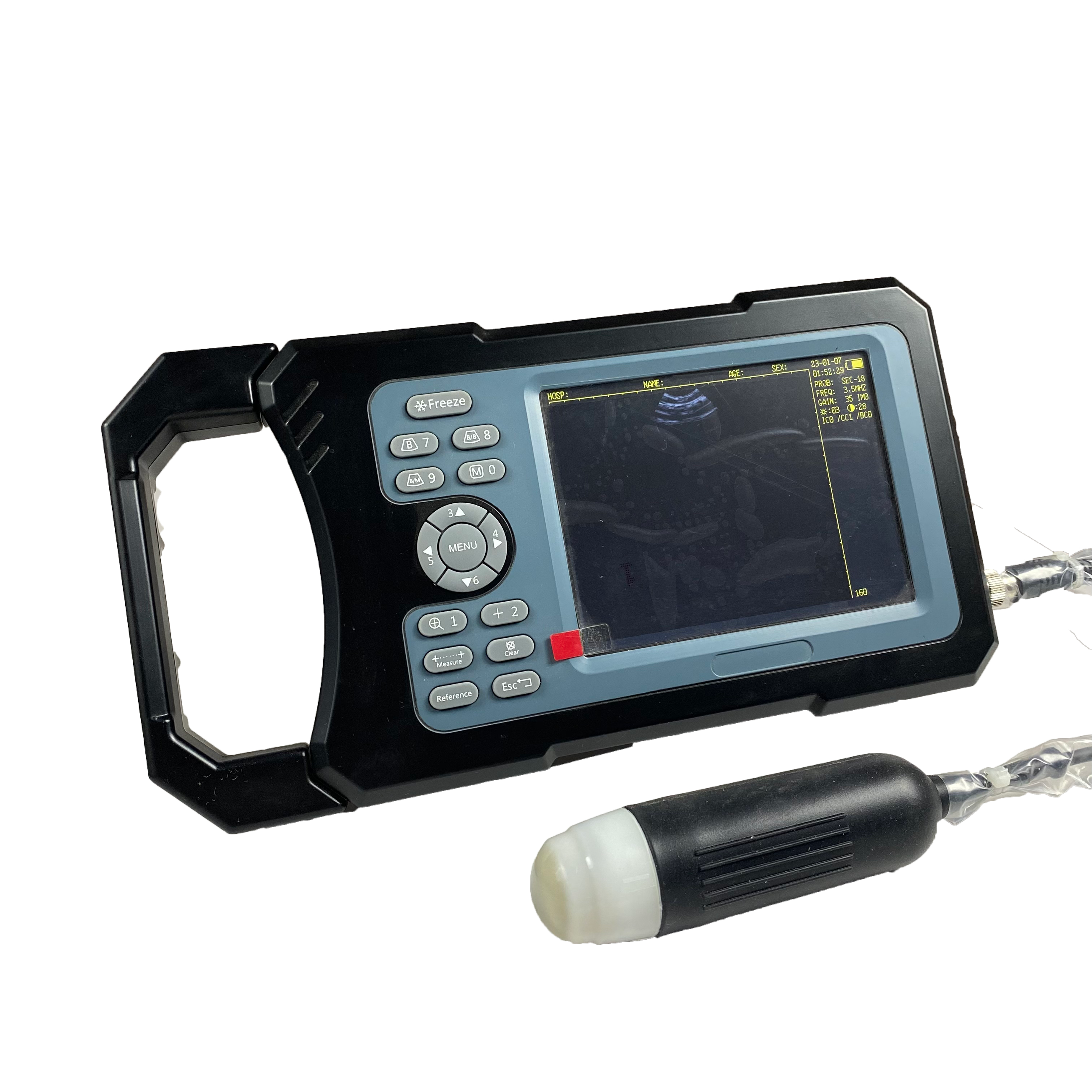 handheld ultrasound scanner