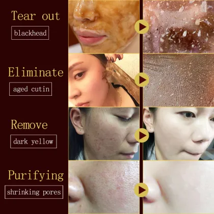 Private label wholesale pore peel off mask pigmentation correctors blackhead remover mask