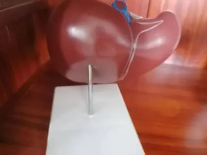 Liver Anatomy Training Model