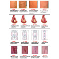 10Pcs Varicose Veins ointment vasculitis treatment Phlebitis Angiitis inflammation blood vessel Rotten legs Varicose Veins Cream