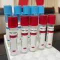 Tubo de PrP de cloreto de cálcio aditivo para coleta de sangue, ISO