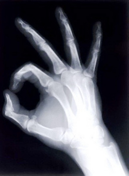 medical dry film,digital film,x ray machine accessories
