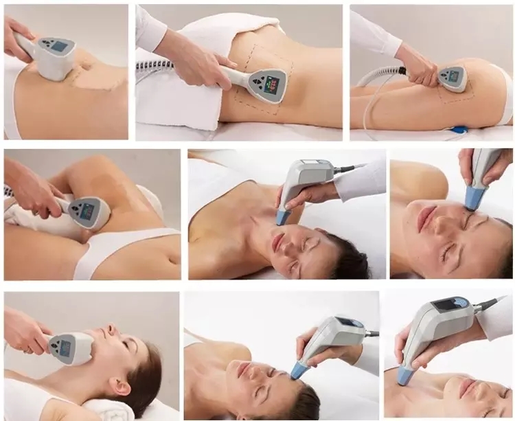 NEW 2 in 1 Monopolar rf exili ultra 360 radio frequency face lifting body shaping machine