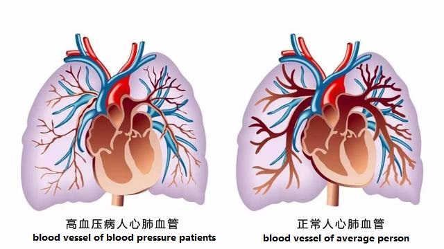 high blood pressure heart