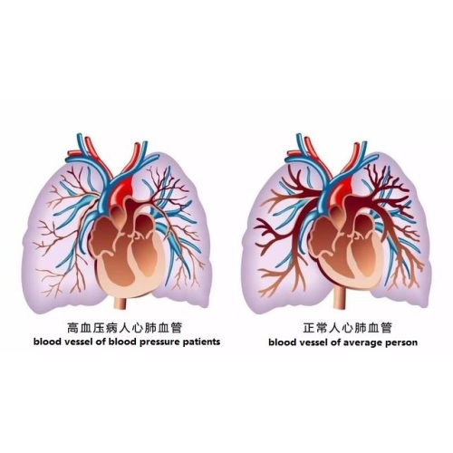 Best way to treat blood pressure diabetic treatment