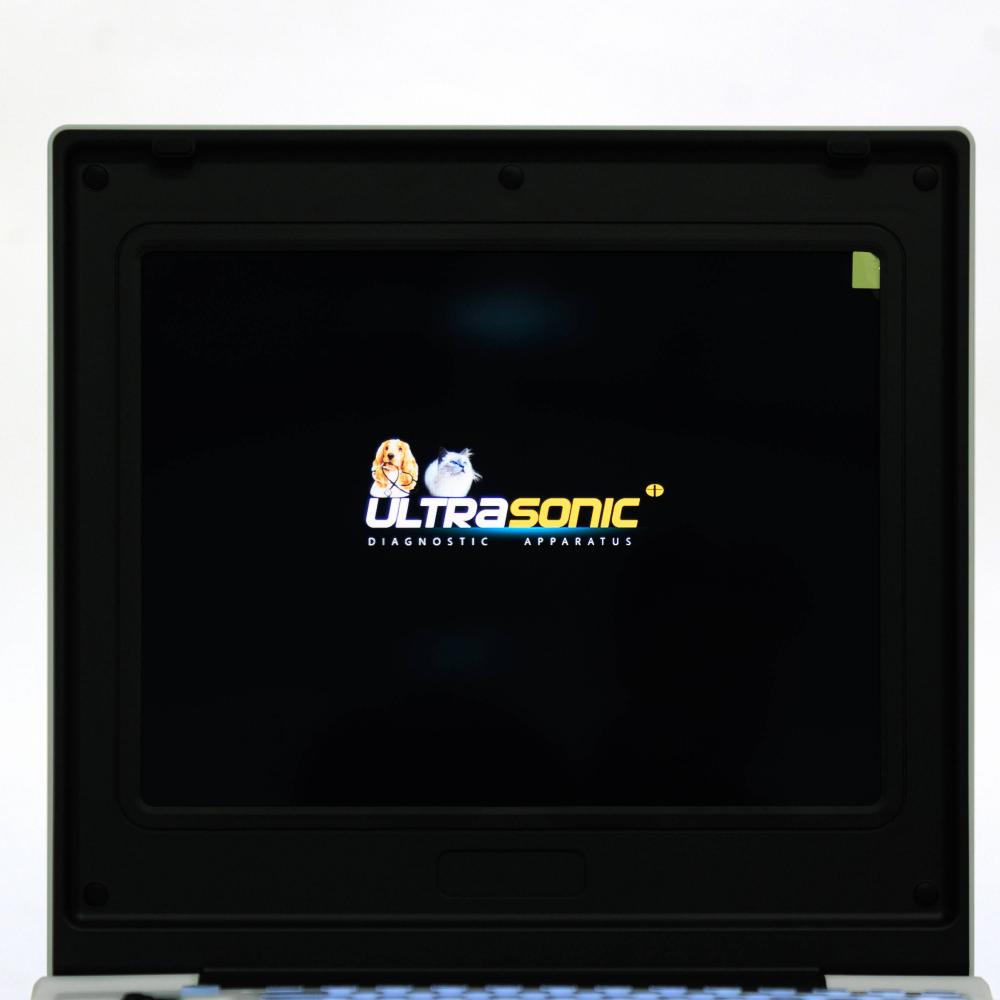 Laptop Ultrasound Screen