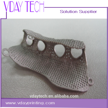Complex geometric 3d printed surgical replacement 3d metal printing