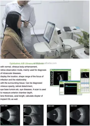 SAB-500 Optical Equipment Ultrasound Scan Ophthalmic AB Scan