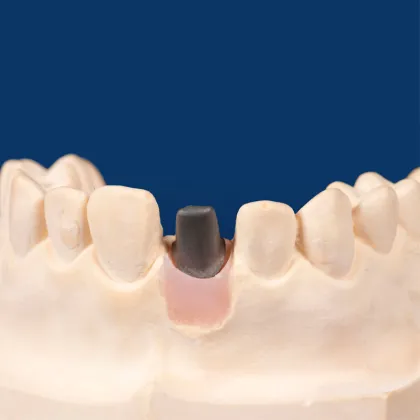 Custom Abutment with Two Brand New Screws