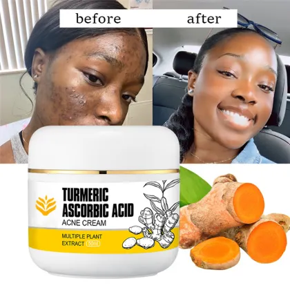 Turmeric and Ascorbic Acid Cream for Skin Whitening and Acne Removal in Dubai