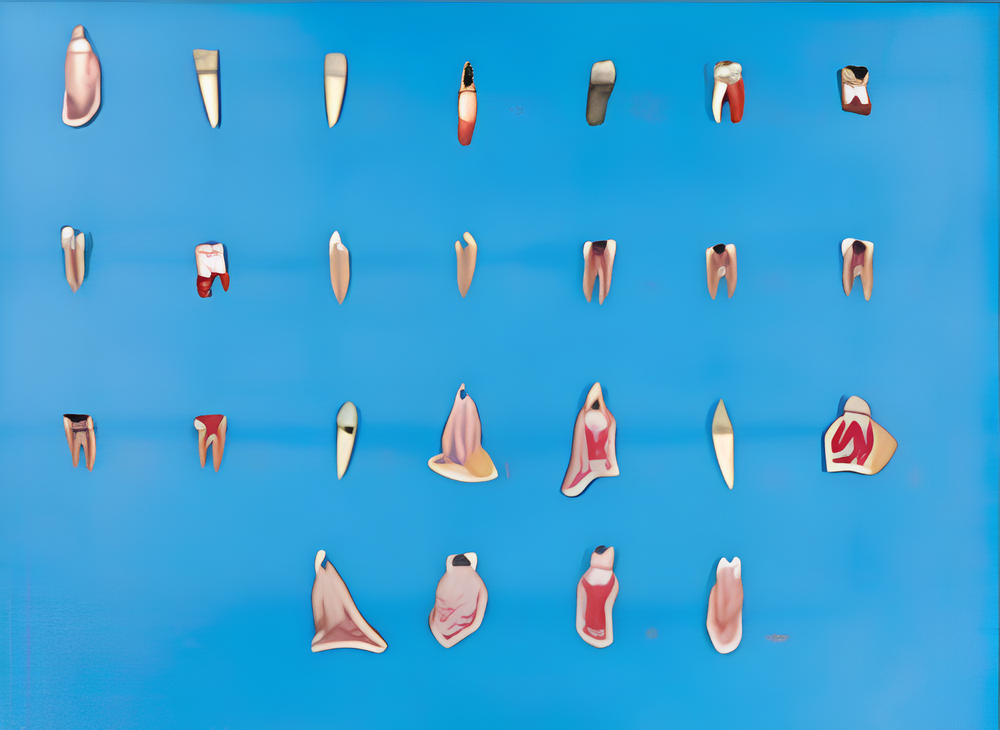 Dental Diseases Model(various oral conditions and diseases)