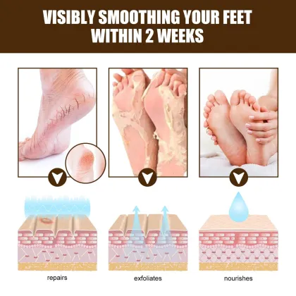 Private Label Dry Foot Crack Repair Horse Oil Hand and Foot Moisture Cream