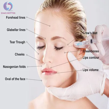 Hyaluronate Acid Gel Dermal Filler to Enhance your Beauty
