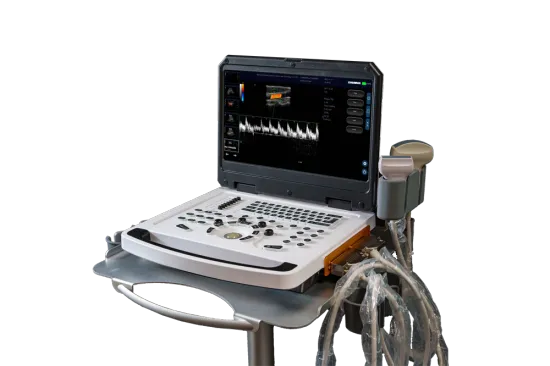 Full digital color doppler machine system image