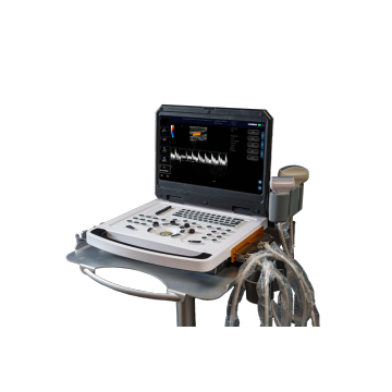 Full digital color doppler machine system image