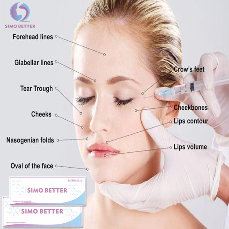 dermal filler 39